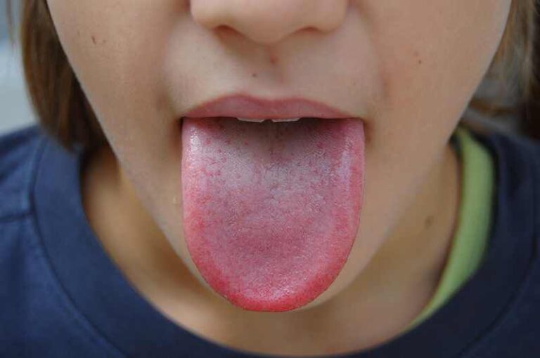 Votre langue est enflée ? Voici les différentes raisons… – Santé
